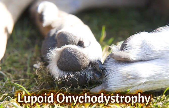 Lupoid-Onychodystrophy